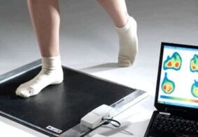 Halluks valgus tanısı