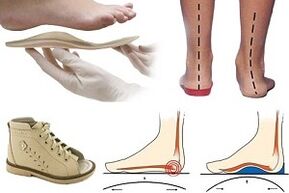 Çocukta halluks valgus için ortopedik ayakkabılar