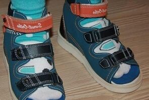 çocukta halluks valgus için sandalet giymek
