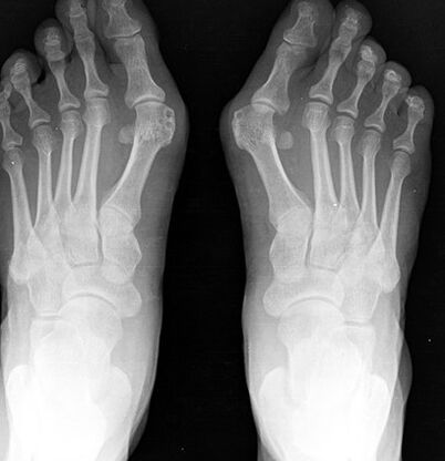 X -Ray.